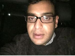 8 Transformasi Mengejutkan Pria Oplas Wajah Mirip Filter IG, Rogoh Rp 2,6 M