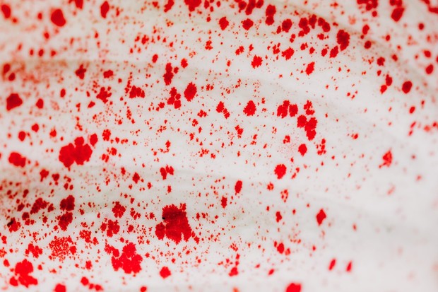 Gejala yang umum terjadi pada penderita batu ginjal adalah urine yang dikeluarkan berwarna merah seperti darah