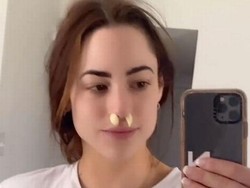 Redakan Sinus, Wanita Ini Taruh Bawang Putih di Lubang Hidung