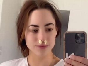 Redakan Sinus, Wanita Ini Taruh Bawang Putih di Lubang Hidung Redakan Sinus, Wanita Ini Taruh Bawang Putih di Lubang Hidung