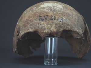 Pria Meninggal 5.000 Tahun Lalu Jadi Korban Wabah Tertua, Apa Buktinya?