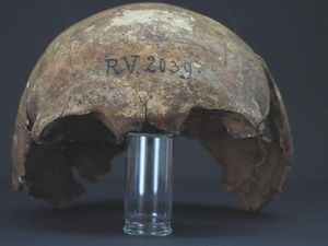 Ini Manusia Pertama di Dunia yang Meninggal Karena Wabah Ini Manusia Pertama di Dunia yang Meninggal Karena Wabah