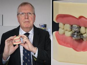 Alat Bikin Sulit Ngunyah Ini Bisa Turunkan BB 6 Kg dalam 2 Minggu