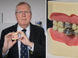 Alat Bikin Sulit Ngunyah Ini Bisa Turunkan BB 6 Kg dalam 2 Minggu