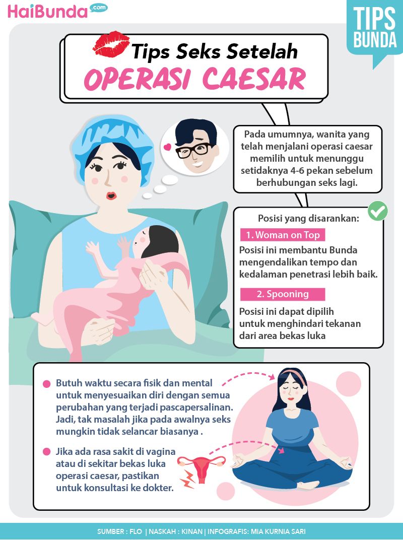 Infografis Tips Seks Setelah Operasi Caesar