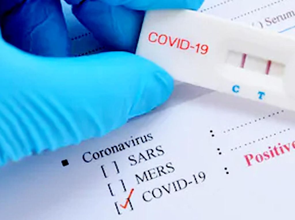 Urgensi Doping Vitamin Bagi Kontak Erat dan Positif COVID-19
