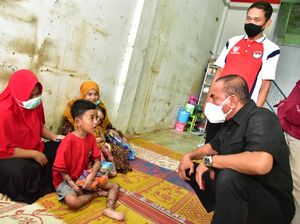 Terkuak Dugaan Limbah Merkuri di Balik Penyakit Kulit Misterius 2 Anak