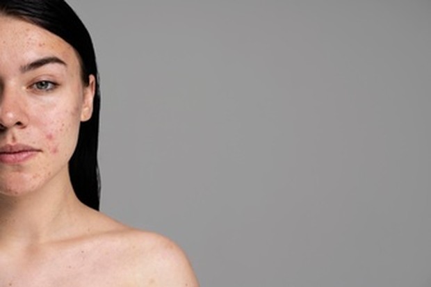 Sensitive skin (sumber : freepik)