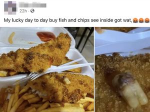 Iyuuh! Wanita Ini Temukan Gigi Manusia dalam Fish & Chips Pesanannya