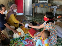 Andre Rosiade Beri Bantuan Balita yang Tersiram Minyak Panas di Padang