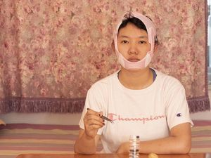 Operasi Plastik Marak di Kalangan Anak Muda di China Meski Bahaya Mengintai