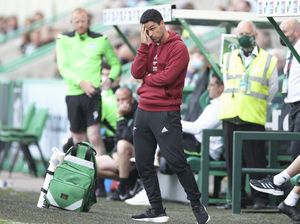 Arteta Masih Belum Move On dari Kekalahan Arsenal di Uji Coba