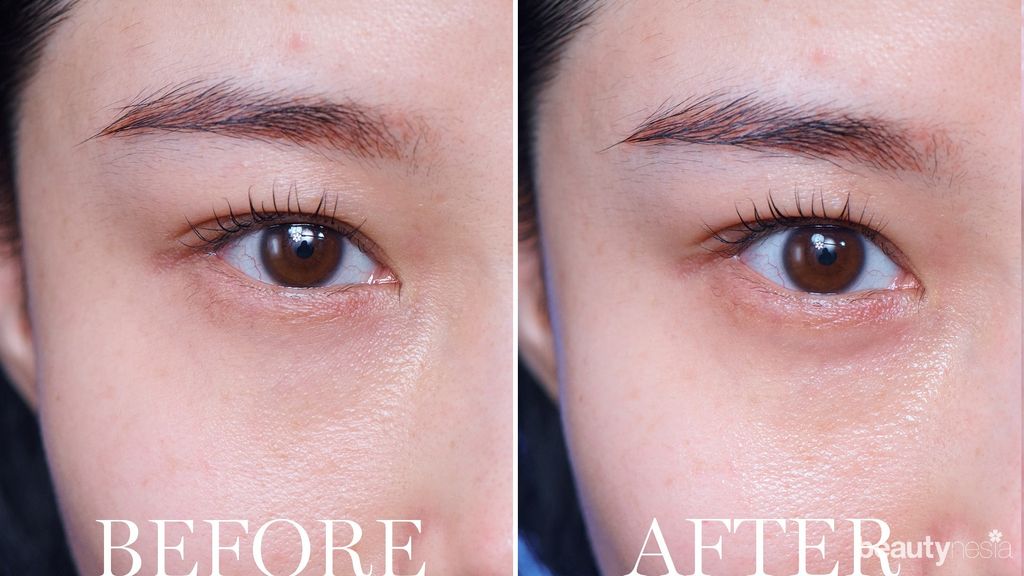 Kirm mata Lancome Advanced Genifique Yeux