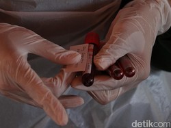 PMI: Stok Plasma Konvalesen untuk Pasien COVID-19 Sangat Kurang!