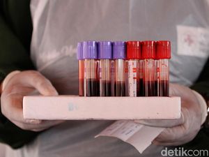 Kenapa WHO Tak Rekomendasikan Plasma Konvalesen untuk Covid-19? Kenapa WHO Tak Rekomendasikan Plasma Konvalesen untuk Covid-19?