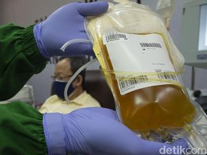 Plasma Konvalesen Dapat Cegah Gawat Janin Pada Bumil Terpapar Covid-19 Plasma Konvalesen Dapat Cegah Gawat Janin Pada Bumil Terpapar Covid-19