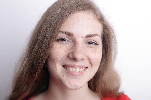 Glycolic acid/pexels.com/Andrea Piacquadio Glycolic acid