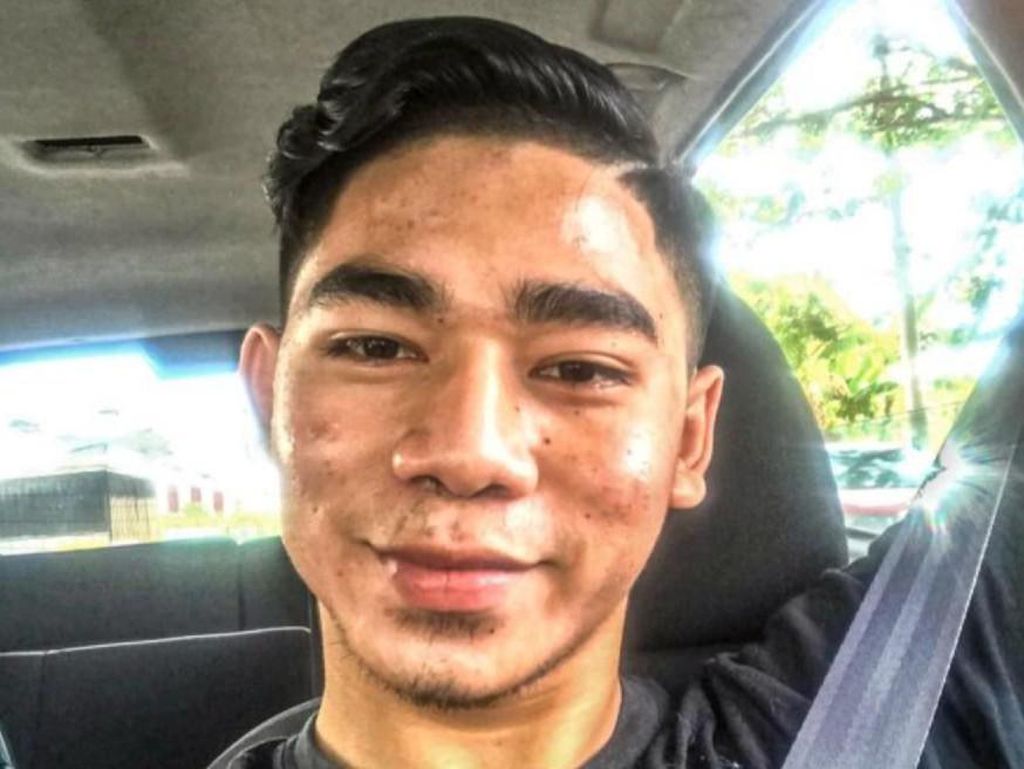 Dulu Dibully Wajah bak Jalanan Rusak, Transformasi Pria Ini Bikin Terkejut Dulu Dibully Wajah bak Jalanan Rusak, Transformasi Pria Ini Bikin Terkejut