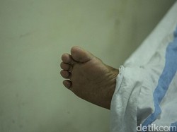 Diserang Gelombang Omicron, Wamenkes Ungkap 3 Kondisi Sebabkan Pasien Meninggal