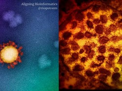 Fakta Terbaru Varian Delta, Penampakan dan Alasan Lebih Gampang Menular