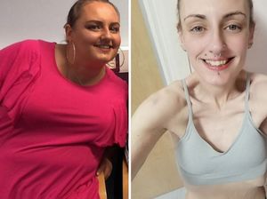 Kecanduan Obat Pencahar dan Minuman Diet, Wanita Obesitas Ini Jadi Anoreksia