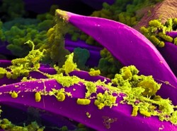 Ilmuwan Temukan Vaksin Baru Wabah Black Death untuk Manusia