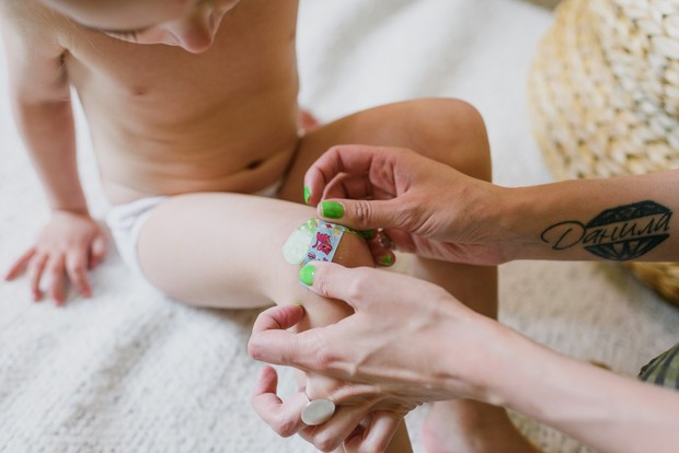 Aloe Vera bisa mempercepat penyembuhan luka