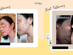 Adara Bee Clear Terjual Setiap 2 Menit di Indonesia