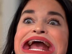 Kisah Pilu Wanita Pemegang Rekor Mulut Terbesar di Dunia, Sering Di-bully