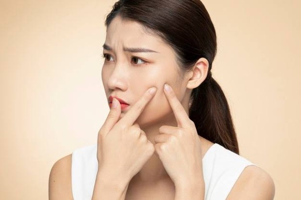 (Waspada jerawat! jangan minum kopi berlebihan/Foto: Freepik.com) Waspada jerawat! jangan minum kopi berlebihan/Foto: Freepik.com