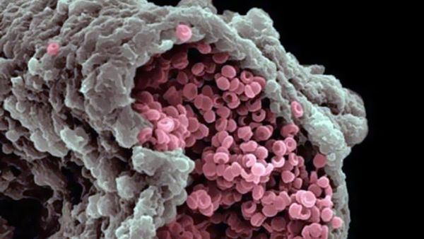 Mencengangkan! Foto Bagian Tubuh & Benda  Sekitar Dilihat dari Mikroskop