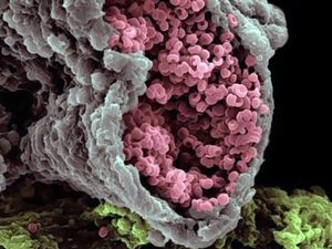 Mencengangkan! Foto Bagian Tubuh & Benda  Sekitar Dilihat dari Mikroskop