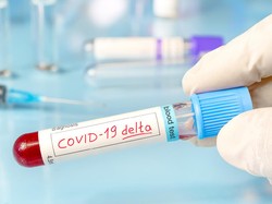 BOR RS COVID-19 di Surabaya Turun hingga di Bawah 10%