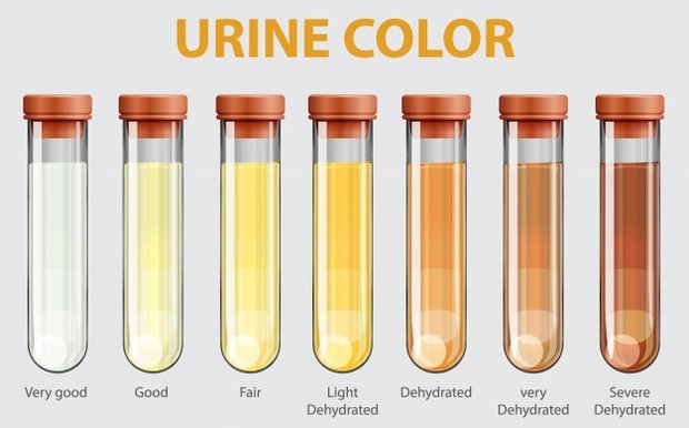 Dehidrasi mempengaruhi warna urine/Foto: freepik.com