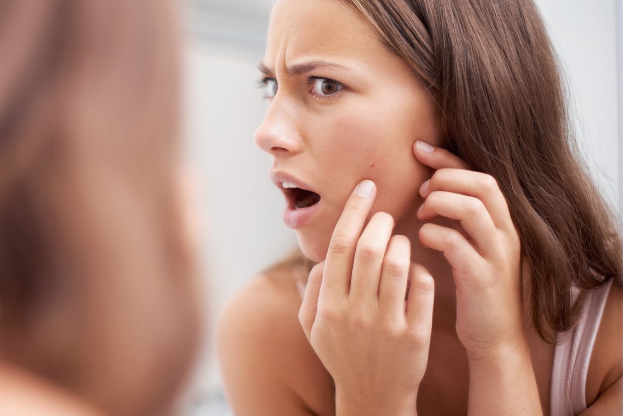 A young woman looking shocked as she examines her skin