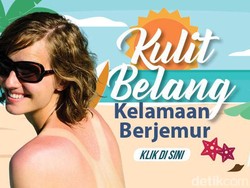 6 Cara Samarkan Kulit Belang akibat Kelamaan Berjemur
