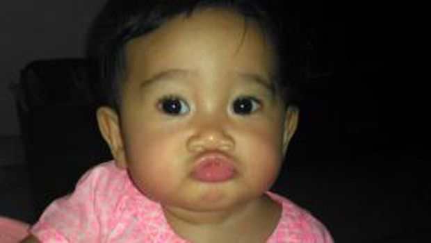 Neyra, Balita yang Meninggal Karena Sepsis