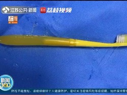 Tragis! Pria Ini Jalani Operasi Perut Setelah Menelan Sikat Gigi