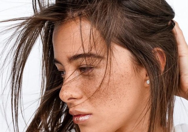 Ilustrasi wanita dengan freckles/Pexels.com/ Julia Kuzenkov