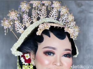 Kisah Lengkap Pengantin Kecelakaan, Wajahnya Viral Bikin Pangling Saat Nikah