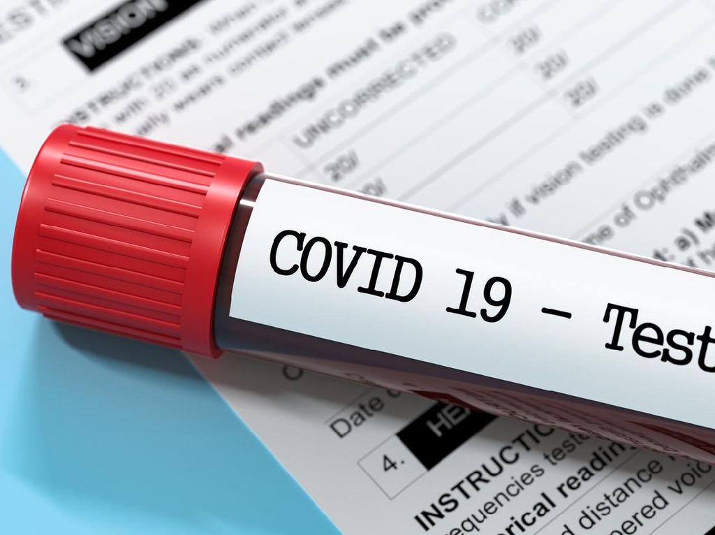 Bukan Penentu Diagnosis COVID-19, Lalu Apa Fungsi CT Value? Ini Kata Ahlinya