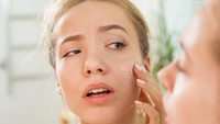 Kulit Masih Kering Meski Pakai Moisturizer? Ternyata Ini 9 Penyebabnya