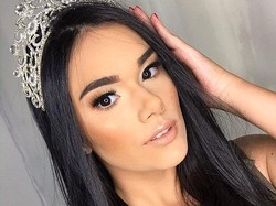 Ratu Kecantikan Meninggal Dunia di Usia 21 Saat Menjalani Operasi