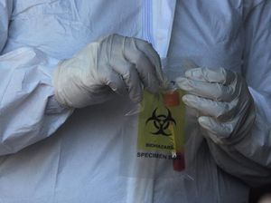 Jokowi Minta Harga PCR Turun, Bobby Soroti Layanan Tes-Limbah di Medan