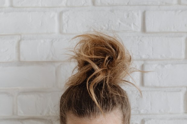 masalah rambut