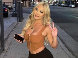 Kisah Wanita Operasi Bokong, Harus Buang Air Kecil dan Besar Sambil Berdiri