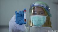 Menanti Turunnya Harga Tes PCR