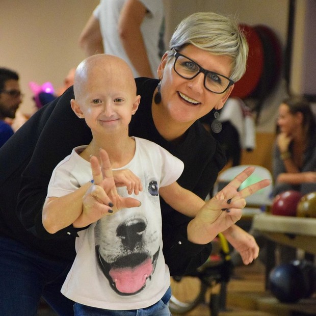Pengidap progeria di dunia / Foto : instagram.com/amber.vandeweert/ Pengidap progeria di dunia / Foto : instagram.com/amber.vandeweert/