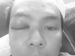 Pengacara: Ryan Tak Cuma Dipukul Habib Bahar, Tangannya Disayat Pengkhianat Pengacara: Ryan Tak Cuma Dipukul Habib Bahar, Tangannya Disayat Pengkhianat