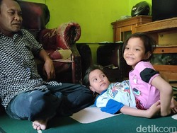 Menengok Aktivitas Bocah Kembar Siam Dempet Perut di Garut